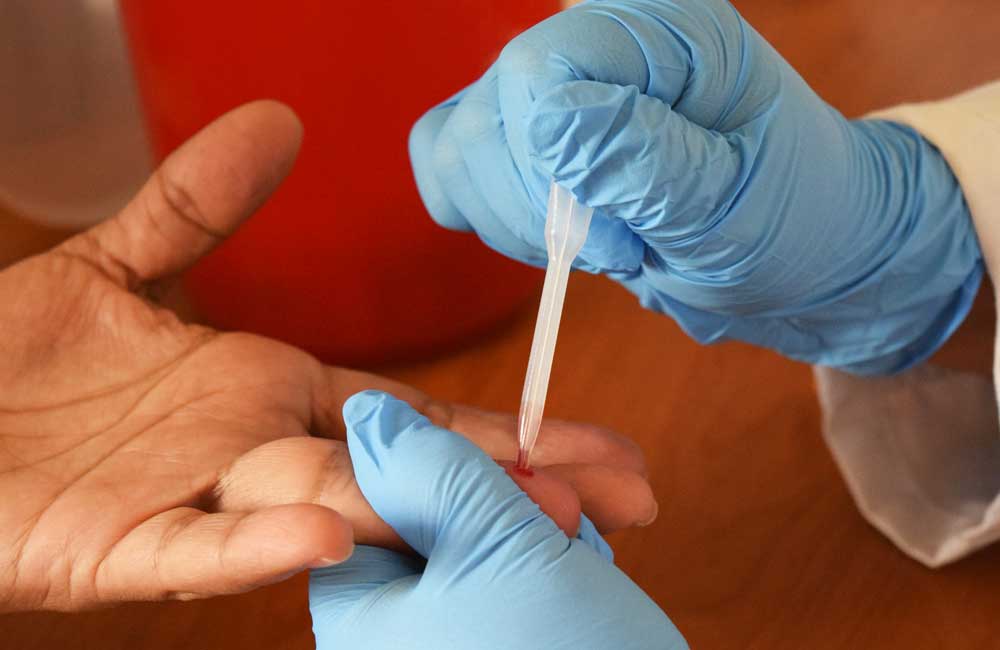 Exhorta Coesida a realizarse prueba de detección del VIH 2 veces al año