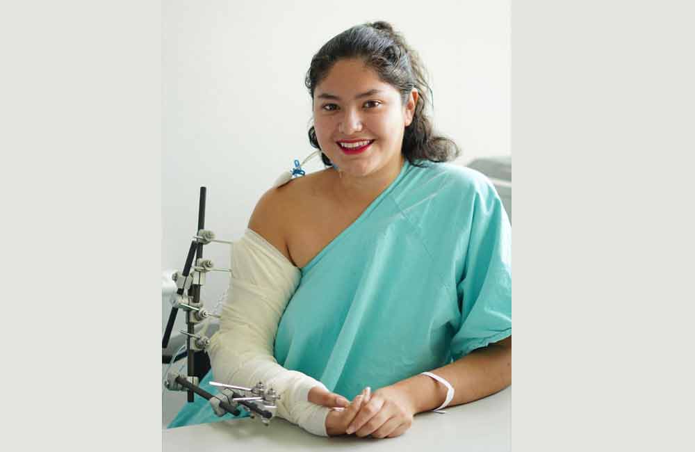 Especialistas del IMSS Guanajuato realizaron con éxito trasplante total de brazo