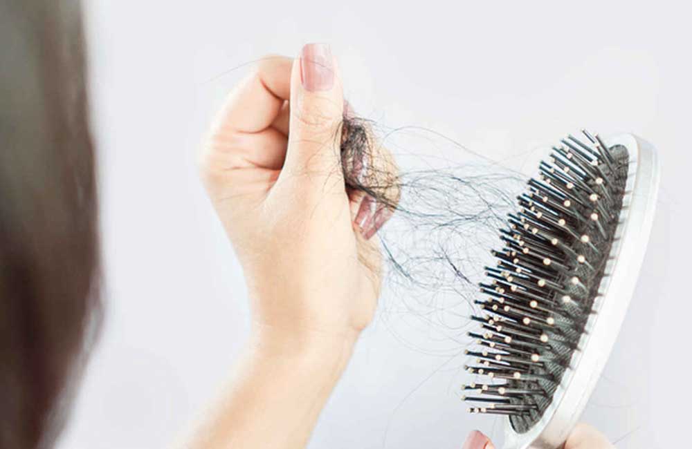 ¿Se te cae el cabello luego de tener covid? Expertos te cuentan lo que sucede