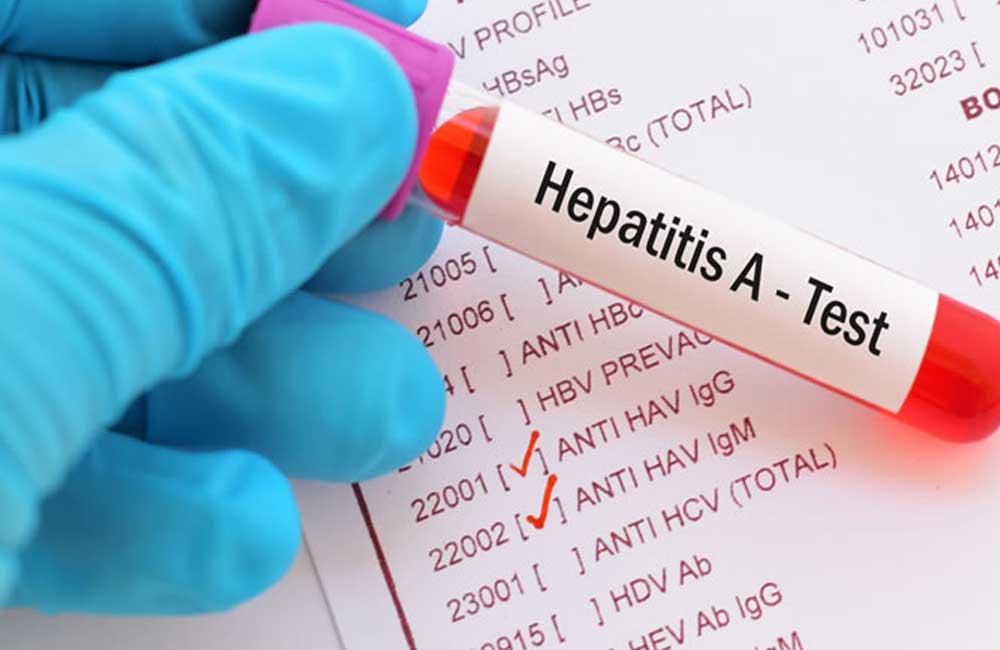 Reportan en Oaxaca 10 casos de hepatitis “A” en lo que va del año: SSO