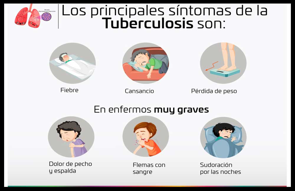Conmemoran SSO Día Mundial de la Lucha contra la Tuberculosis