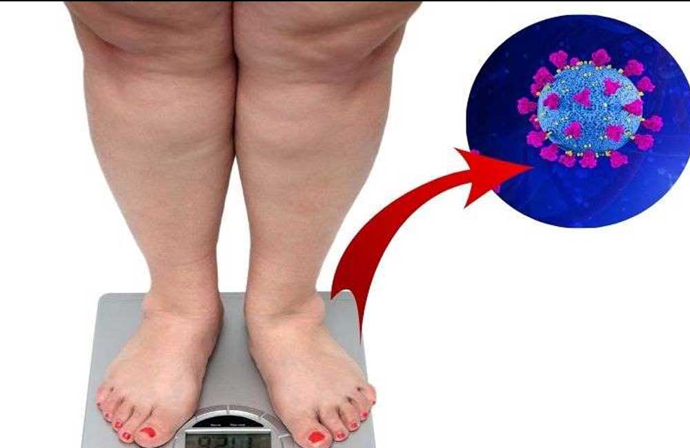 Obesidad puede agravar la vulnerabilidad ante síntomas de Covid-19