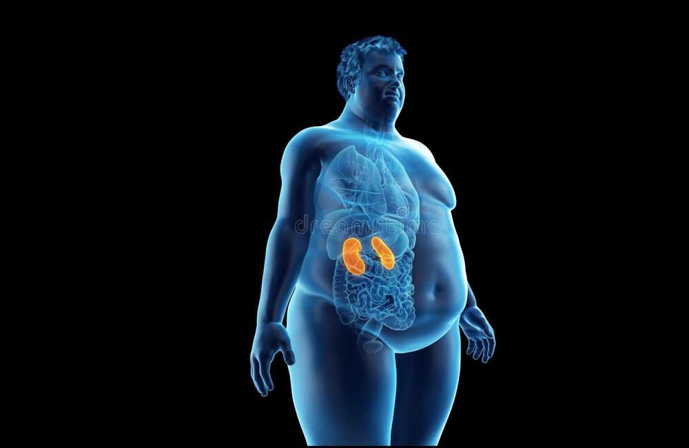 80% de pacientes con enfermedad renal tienen diabetes, hipertensión y obesidad