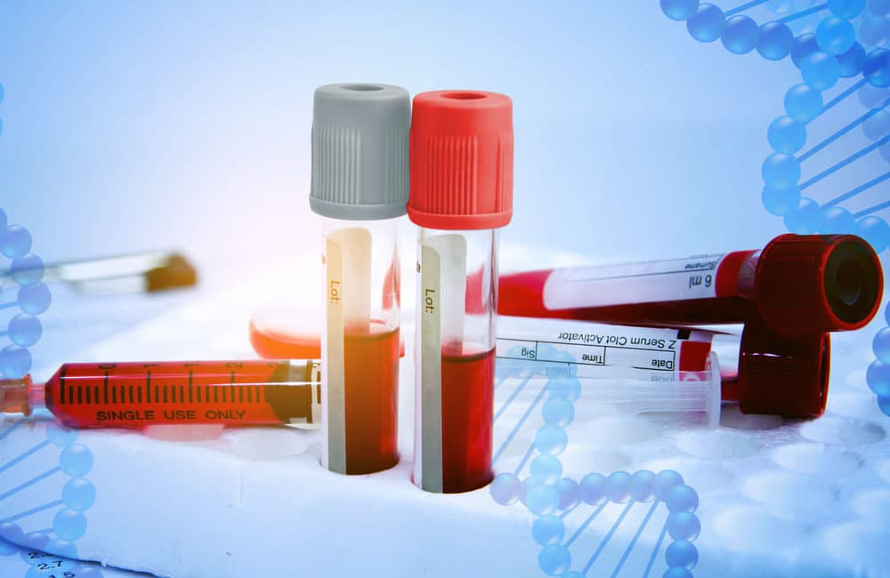 Brinda Issste tratamientos de ingeniería genética a pacientes con hemofilia