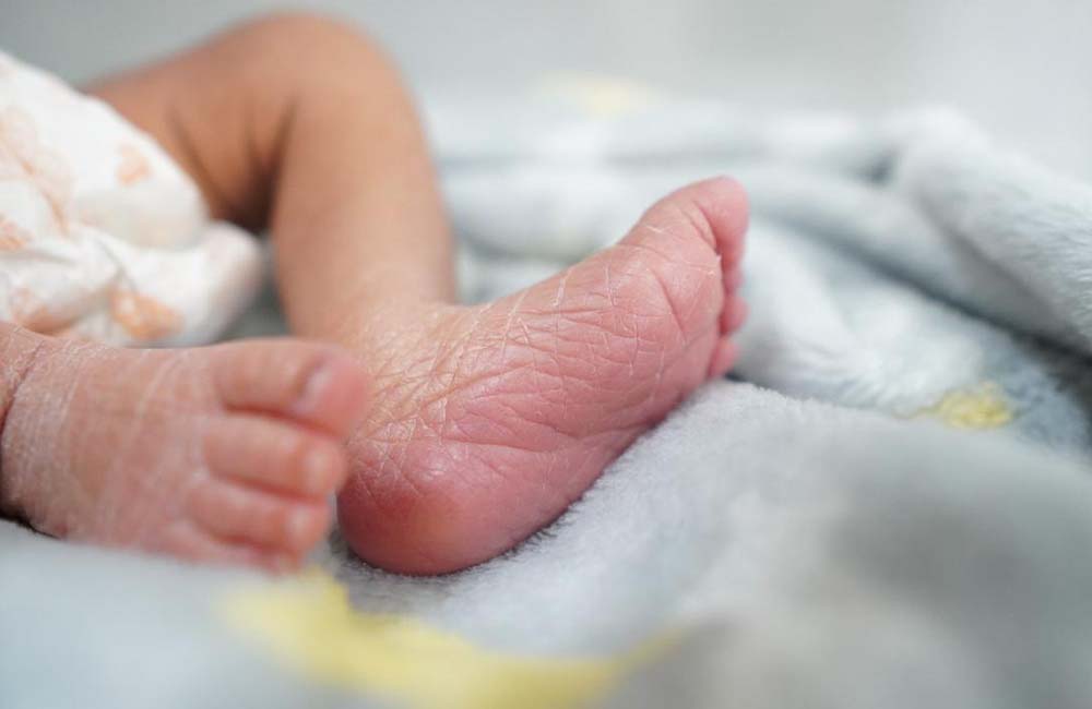 Ausencia de ácido fólico en gestación puede causar espina bífida en recién nacidos: SSO