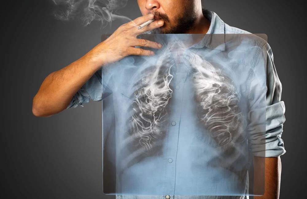 Dejar de fumar reduce el riesgo de padecer cáncer de pulmón: SSO