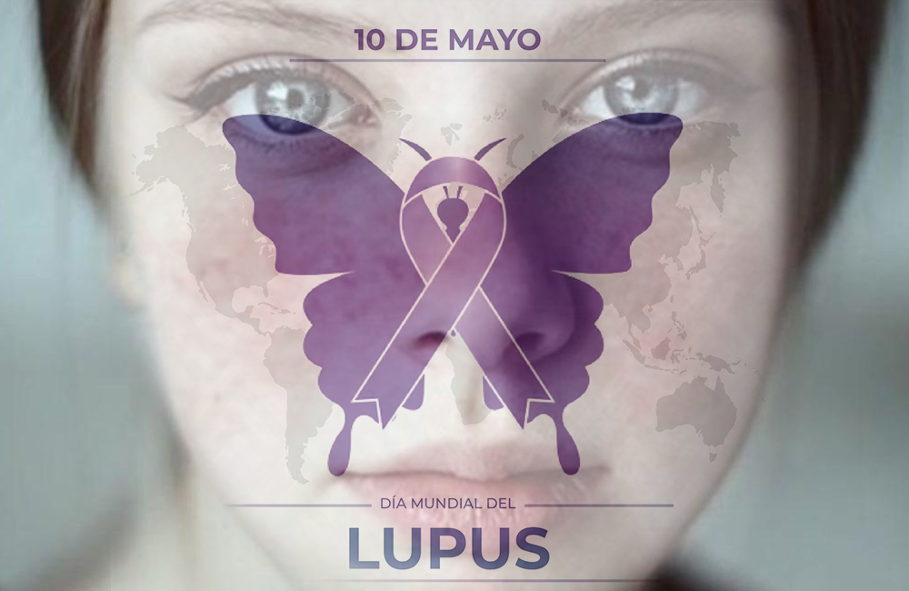 Lupus, una enfermedad que afecta con mayor frecuencia a las mujeres