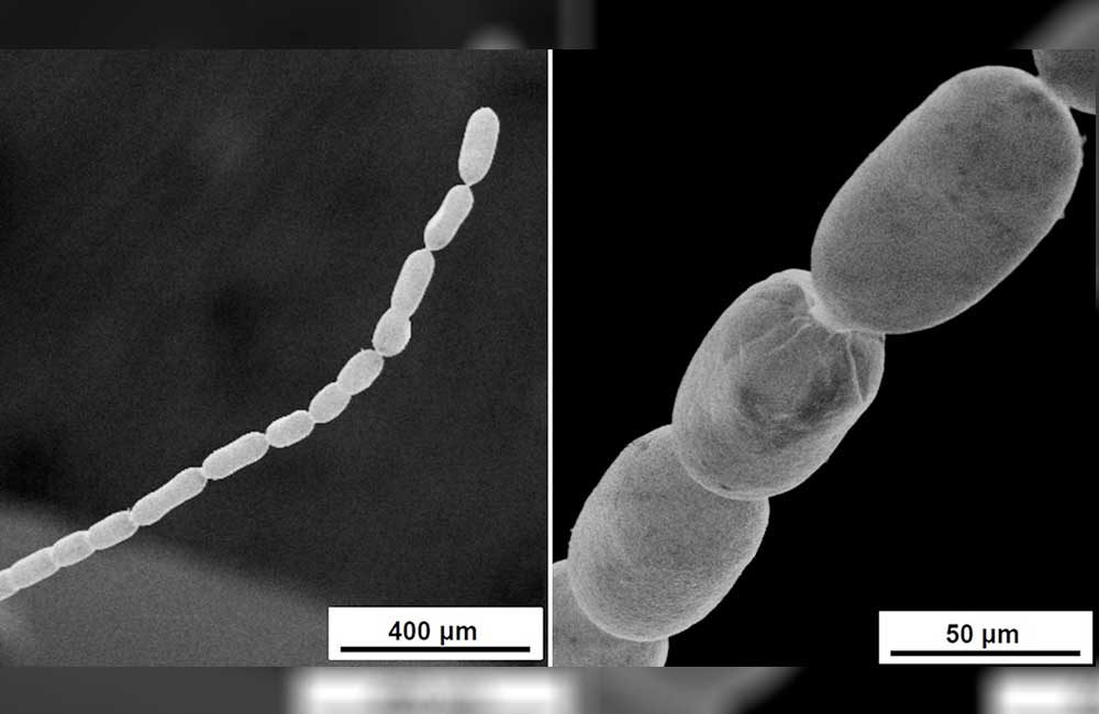 Descubren-la-bacteria-más-grande-jamás-conocida,-que-puede-medir-hasta-2-cm-de-largo-3