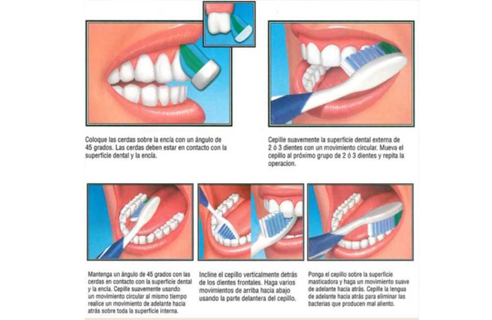 Limpieza-dental