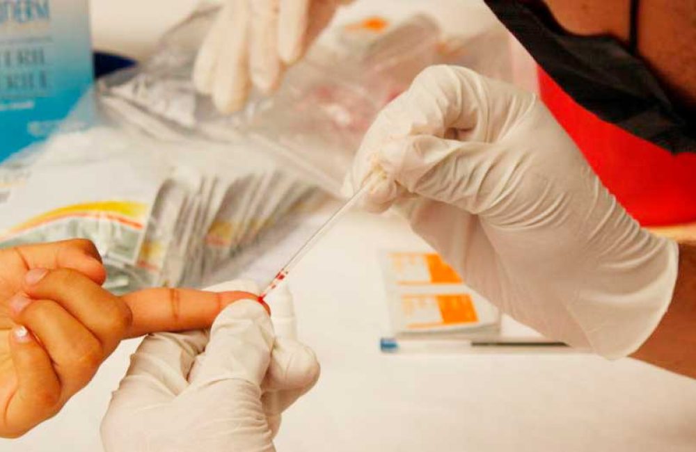 Realizan-pruebas-rápidas-de-VIH-en-San-Jacinto-Amilpas-5